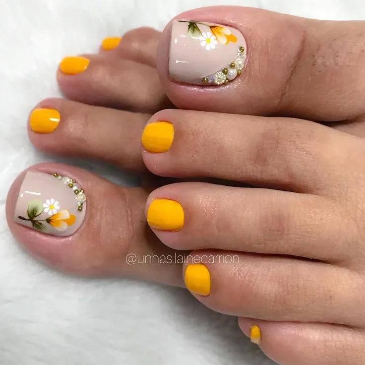 Por que minhas unhas dos pés estão amarelas?