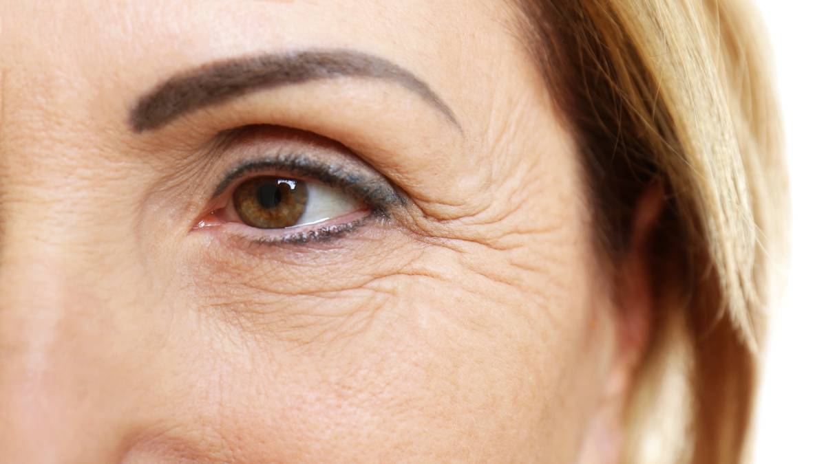 Decifrando o que esses 7 tipos de rugas podem revelar sobre você
